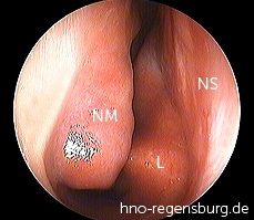 Nasenloch rechts