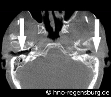 Computertomographie Befund